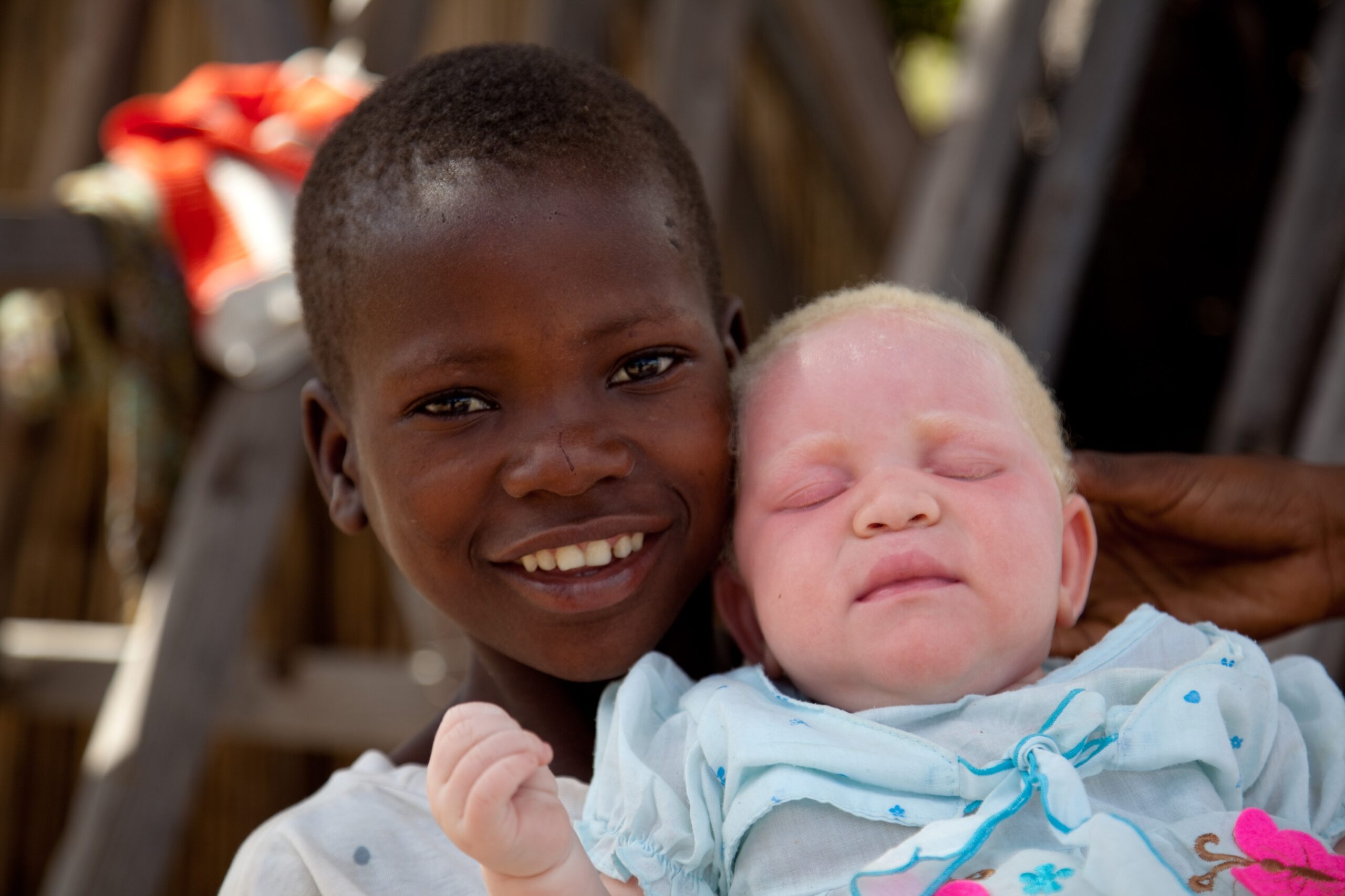 Cómo el mito del albinismo pone en riesgo a los niños de Tanzania