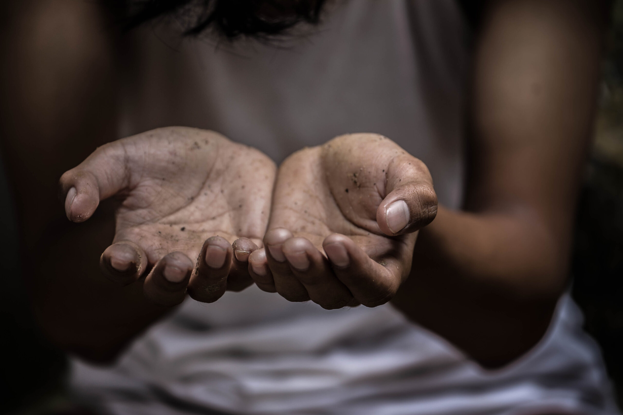 Hands,Poor,Child,In,Slum,Begging,You,For,Help.concept,For